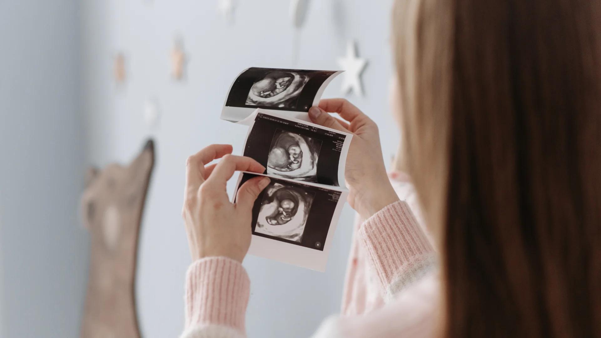 Anuncios de Bebé en Camino: Ideas Originales y Creativas - Cómo dar sorpresas de embarazo anuncios de bebe en camino - Cómo dar sorpresas de embarazo