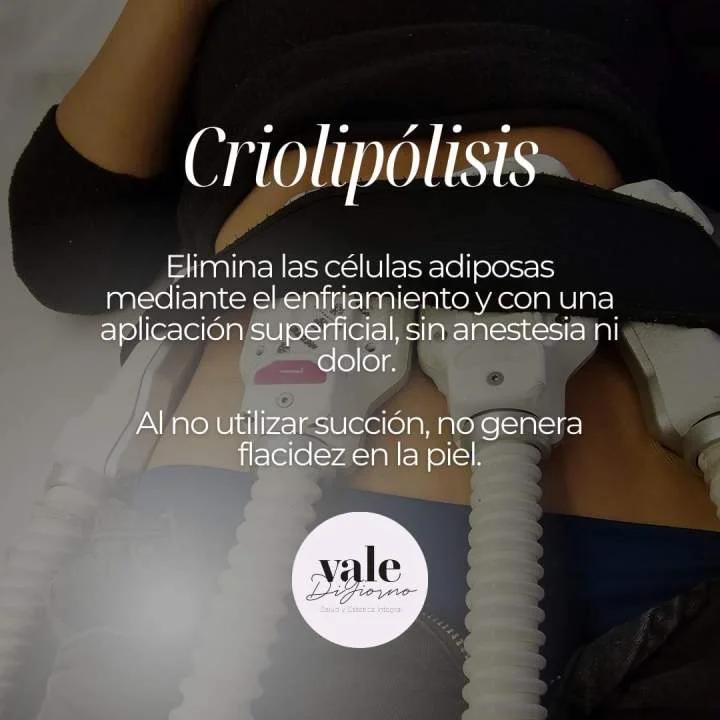 Criolipólisis: Guía Definitiva para Publicidad y Marketing - Cuánto cuesta la criolipólisis en Argentina criolipolisis publicidad - Cuánto cuesta la criolipólisis en Argentina
