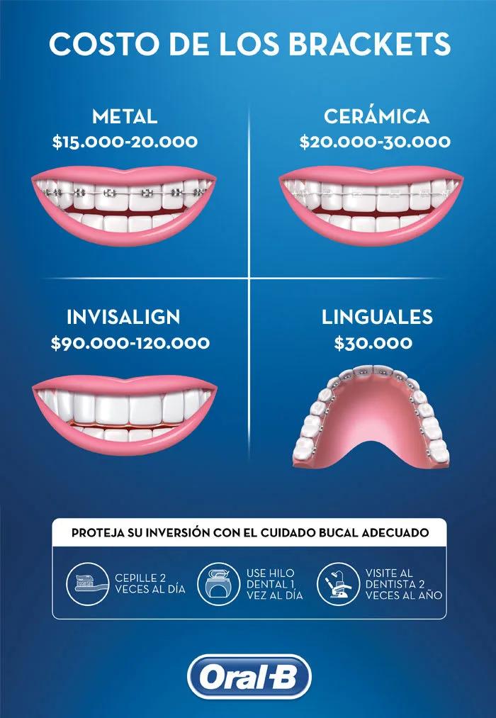 brackets publicidad - Cuánto salen los brackets en Argentina