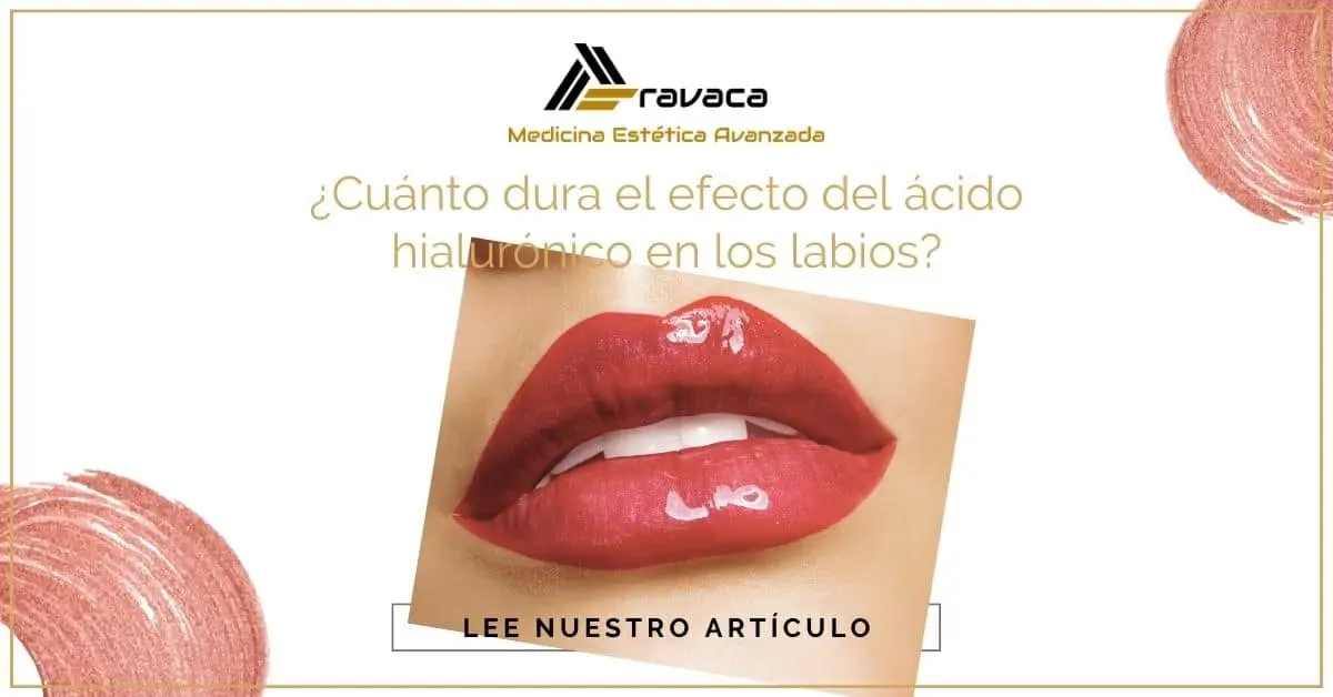 publicidad relleno de labios - Cuánto tiempo dura el relleno de labios