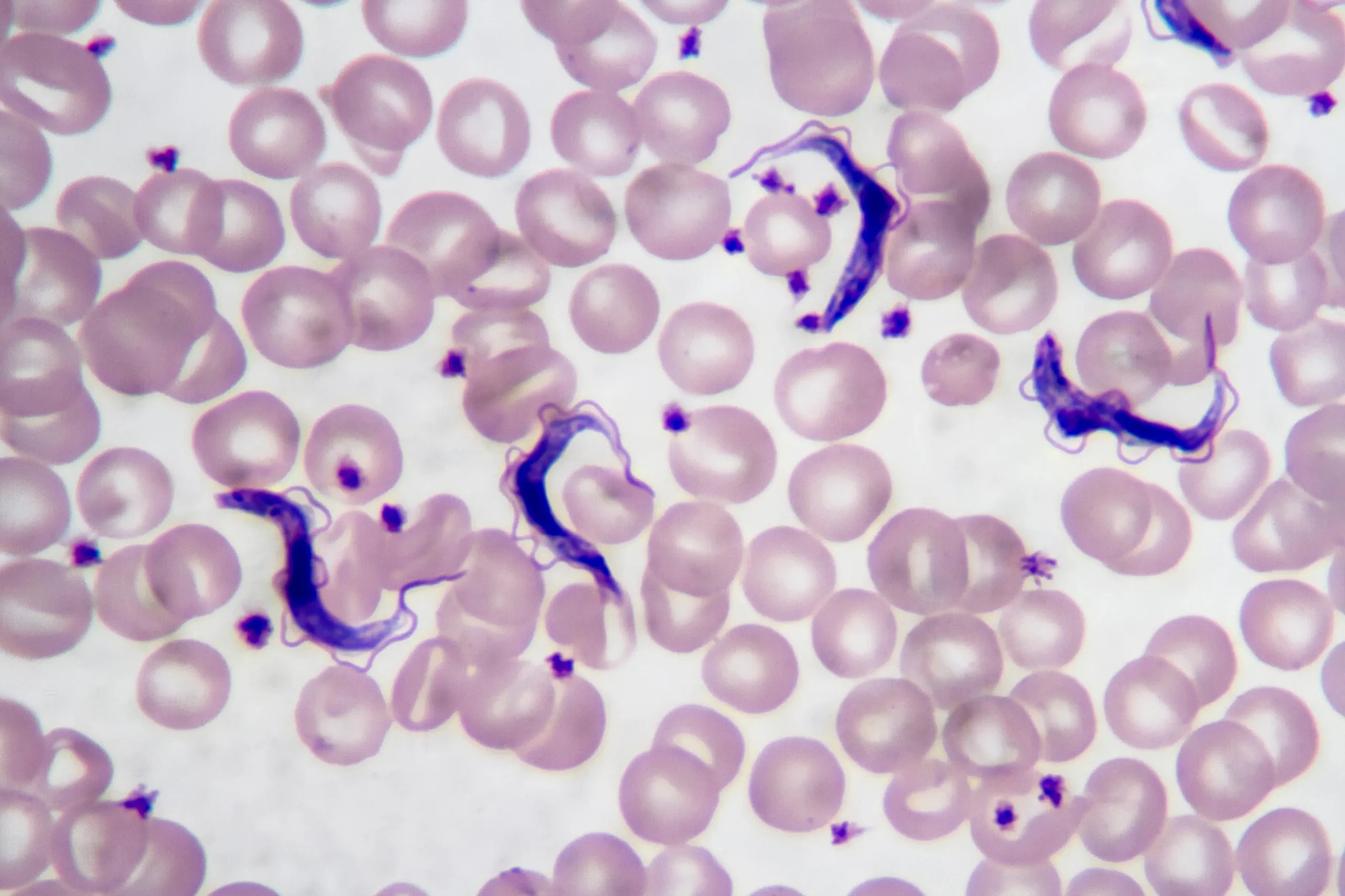 Anuncios mal de Chagas: Información y prevención - Qué animal transmite el mal de Chagas anuncios mal de chagas - Qué animal transmite el mal de Chagas
