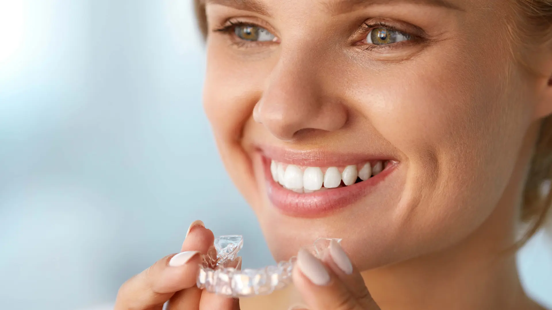 <b>Publicidad Invisalign</b>: Guía completa de costos, proceso y beneficios - Qué es mejor, usar brackets o Invisalign publicidad invisalign - Qué es mejor, usar brackets o Invisalign