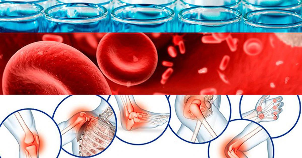 Publicidad Plasma Rico en Plaquetas: Guía Completa - Qué profesional puede aplicar plasma rico en plaquetas publicidad plasma rico en plaquetas - Qué profesional puede aplicar plasma rico en plaquetas