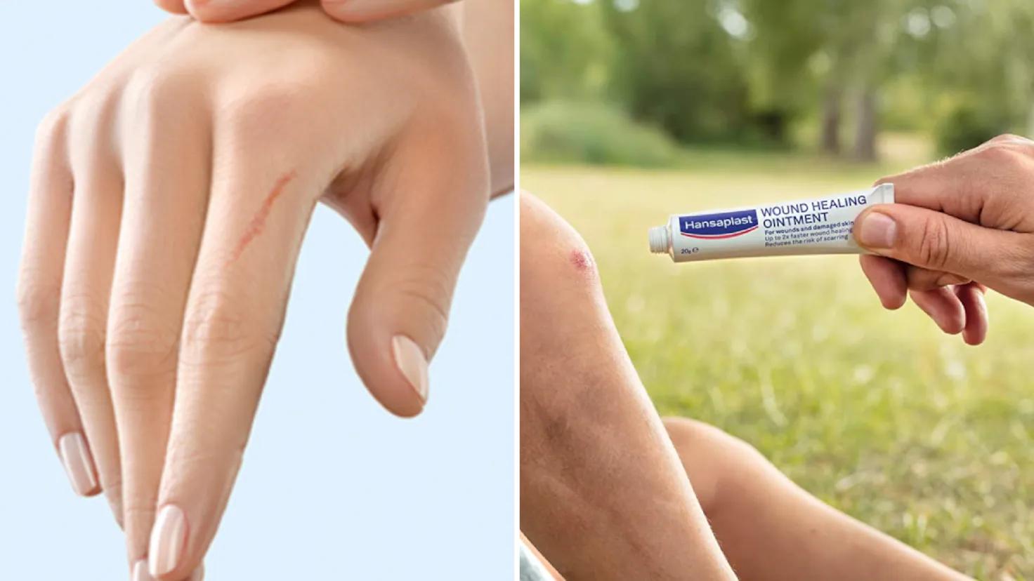 cicatricure publicidad argentina - Qué tan buenos son los productos de Cicatricure